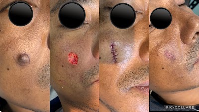 DR DIBYAJYOTI SARKAR MD || BEST DERMATOLOGIST IN MALDA - Image 3
