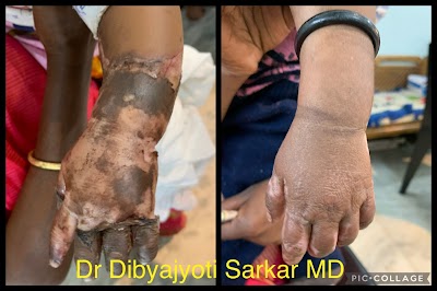 DR DIBYAJYOTI SARKAR MD || BEST DERMATOLOGIST IN MALDA - Image 2