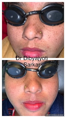 DR DIBYAJYOTI SARKAR MD || BEST DERMATOLOGIST IN MALDA