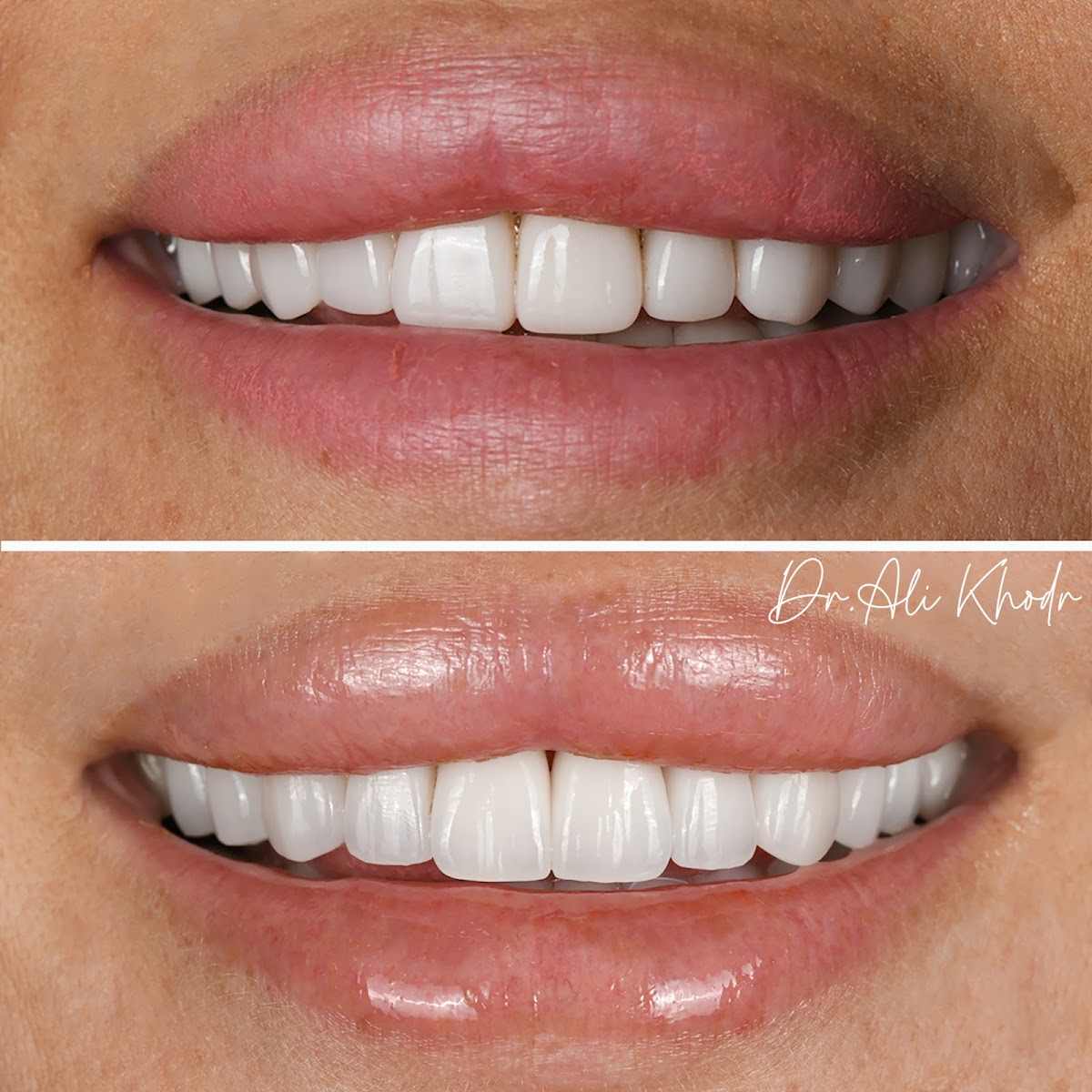 Dr. Ali Khodr | Cosmetic Dentist in Dubai 4