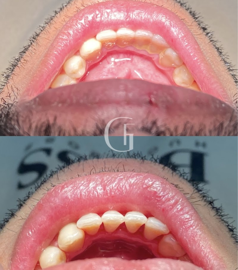 Dra. Gabriela Ferreira | Harmonização Facial em Campo Grande