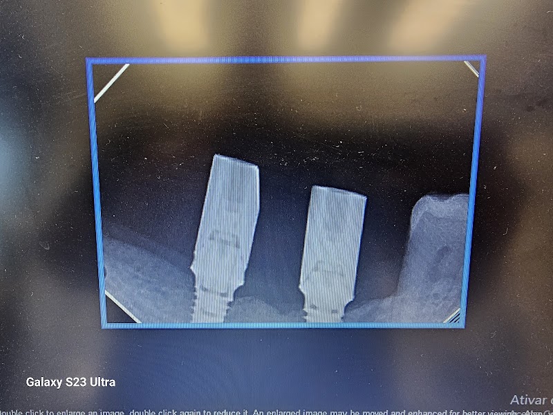 Odontomicroscopia - foto 4