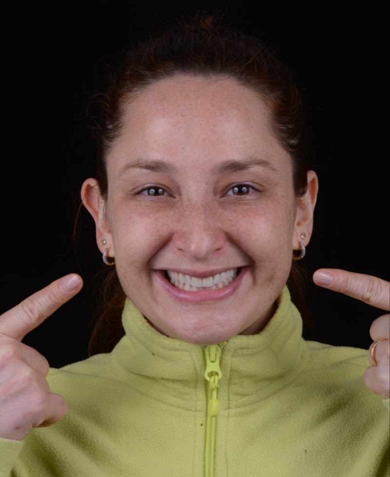 Dr. Rafael Pocztaruk - Implante Dentário Porto Alegre l Lentes em Resina Premium l Faceta Porcelana l Protocolo de Implante