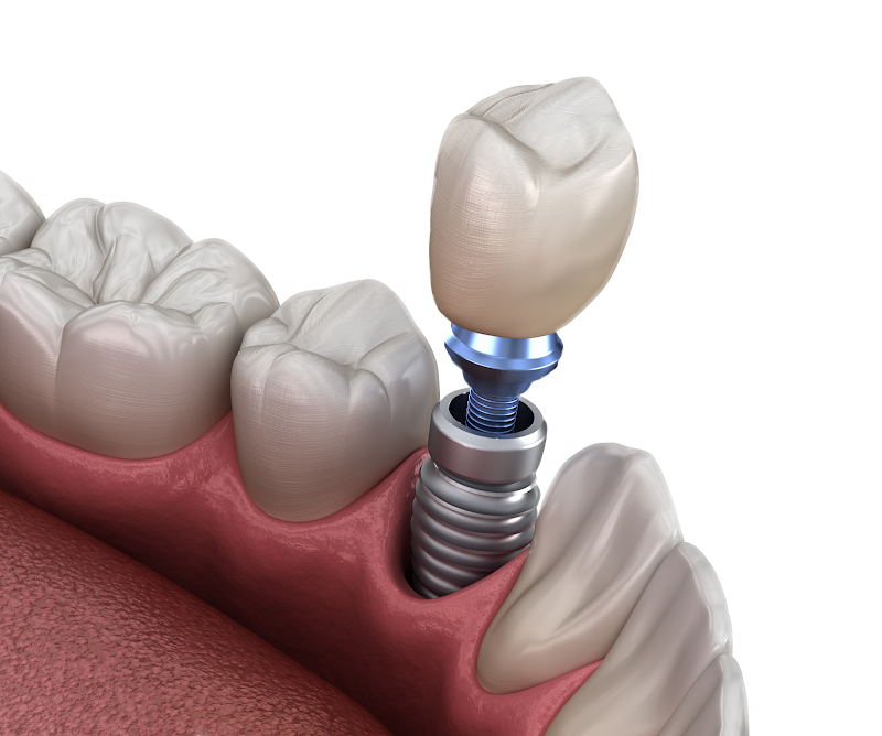 Dental Arte Andradas - foto 3