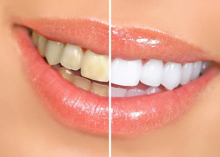 Implodonto Vitória - foto 2