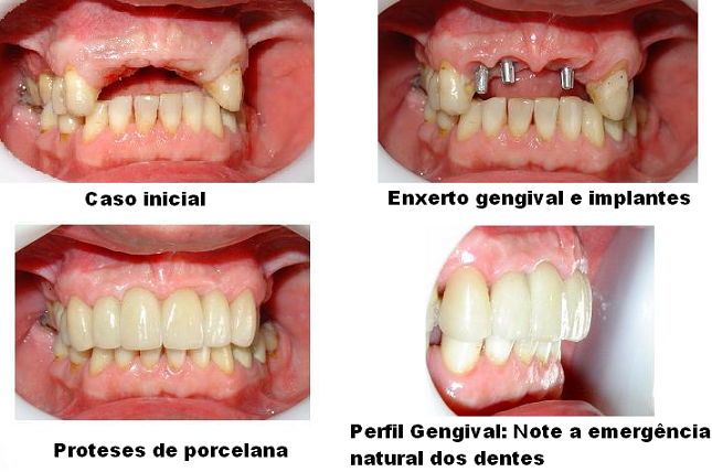 Implodonto Vitória - foto 3