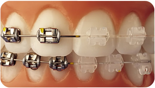 Implodonto Vitória - foto 4