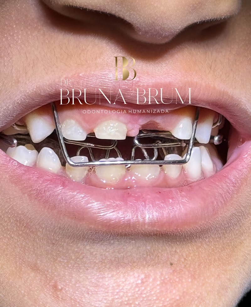 Dra Bruna Brum - Ortodontista em Salvador - foto 4