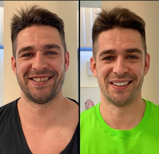 Dra. Ivanilda - Tratamento de Canal | Clínica Odontológico - foto 2