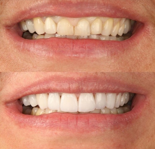 Dra. Ivanilda - Tratamento de Canal | Clínica Odontológico - foto 3