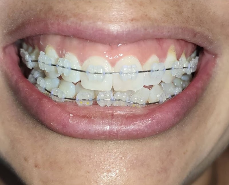 Dra Luciana Costa - Dentista, Ortodontia, Invisalign - foto 5