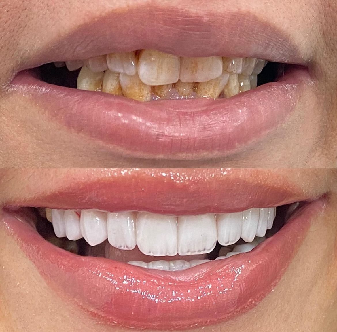 Veneers Dental Centre 2