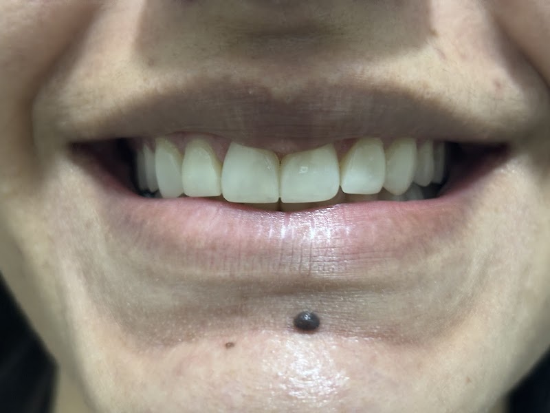 Dentista Salvador - Dra. Maria Santana - foto 4