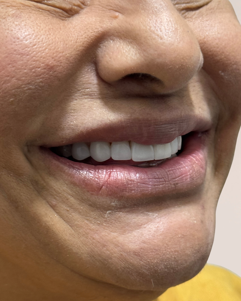 Dentista Salvador - Dra. Maria Santana - foto 3