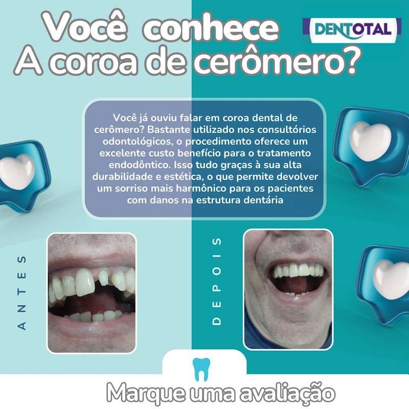 Dentotal Tijuca 2 - Dentista Preço Popular, Dentista - foto 4