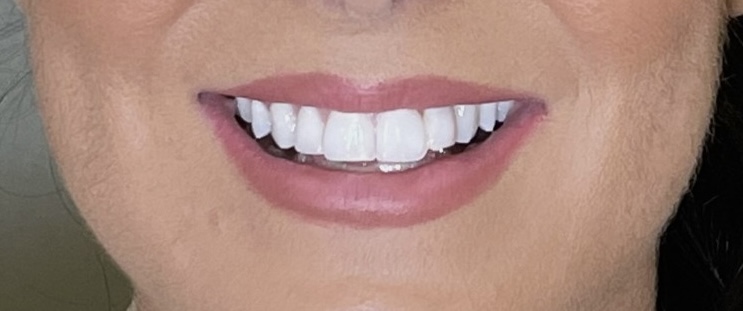 Signature By Dr Naeem - Orthodontic and Dentofacial Aesthetic 5