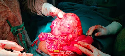 Dr. Pallavi Sahai (Obstetrician & Gynaecologist, Adhartal) - Image 3