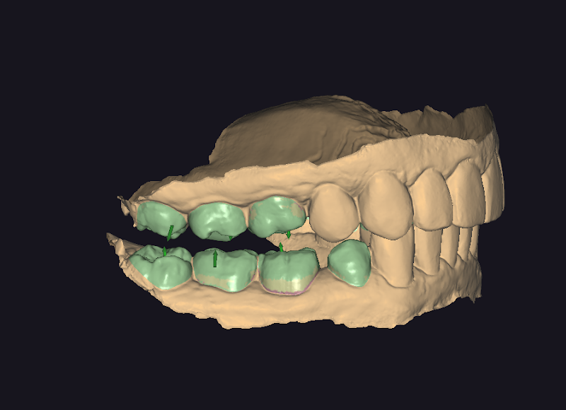Odonto Sul da Ilha - Clínica Odontológica- Dra Karine de Souza - foto 4