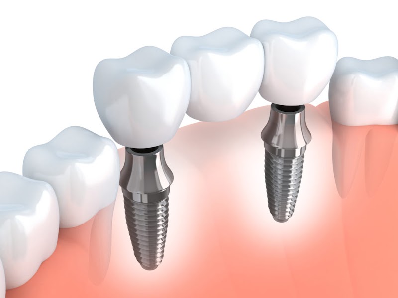 Bismarck Advanced Dental and Implants photo 2