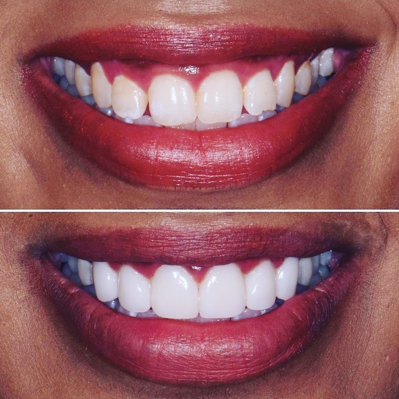 OdontoCompany Aracaju - Implantes - Facetas - Próteses - Aparelho Ortodôntico - foto 3