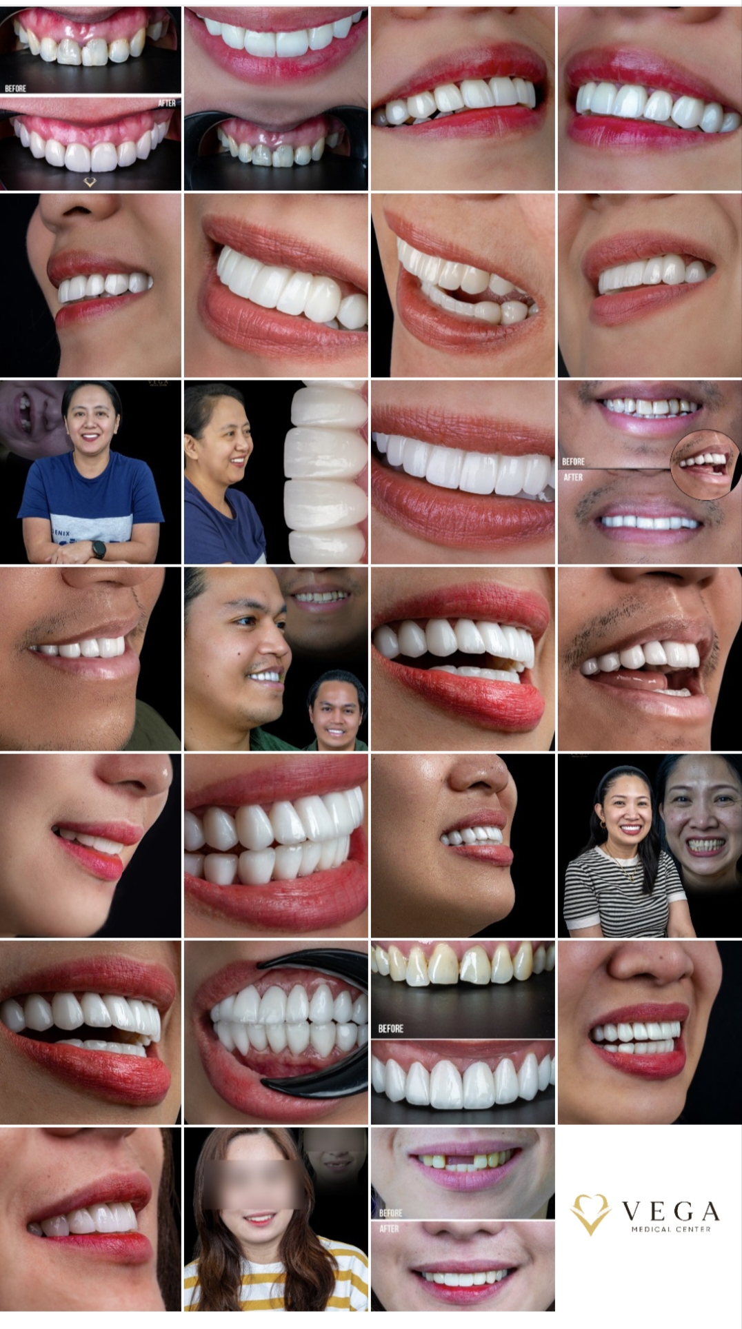 Vega Medical Center - Dental & Aesthetic Clinic Al Rigga, Deira