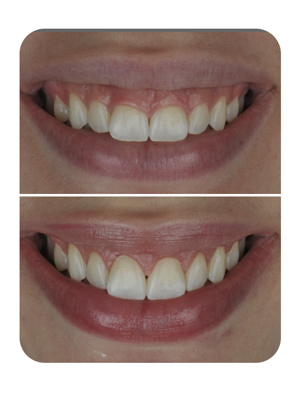 Dra. Leninha Dentista Periodontista - foto 3
