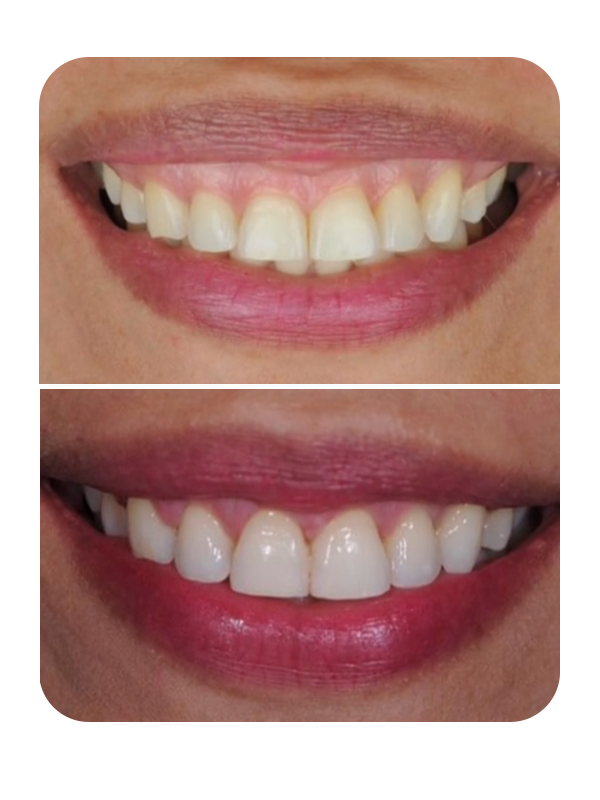 Dra. Leninha Dentista Periodontista - foto 4