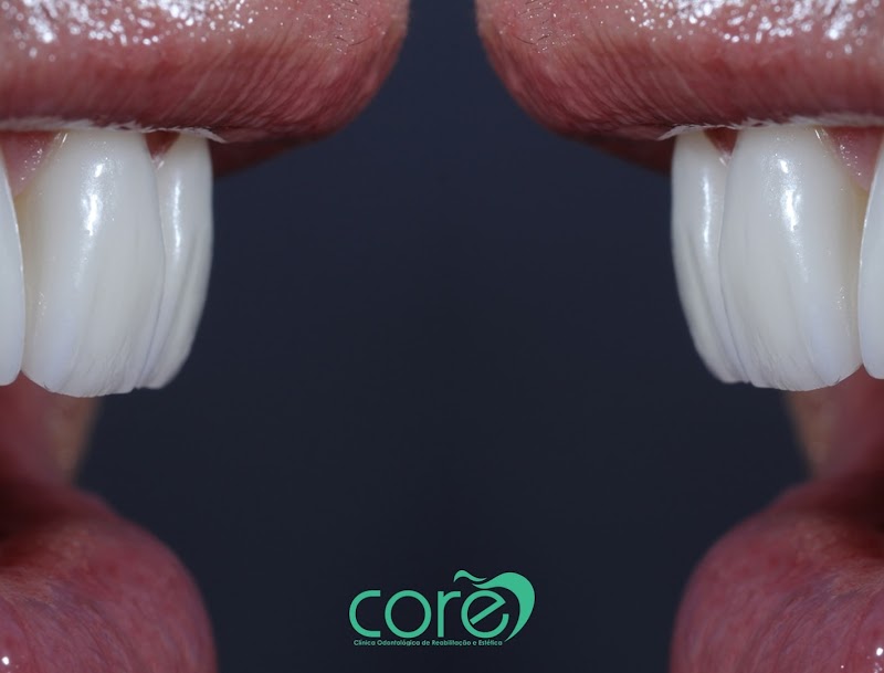 CORE - Clínica Odontológica de Reabilitação e Estética