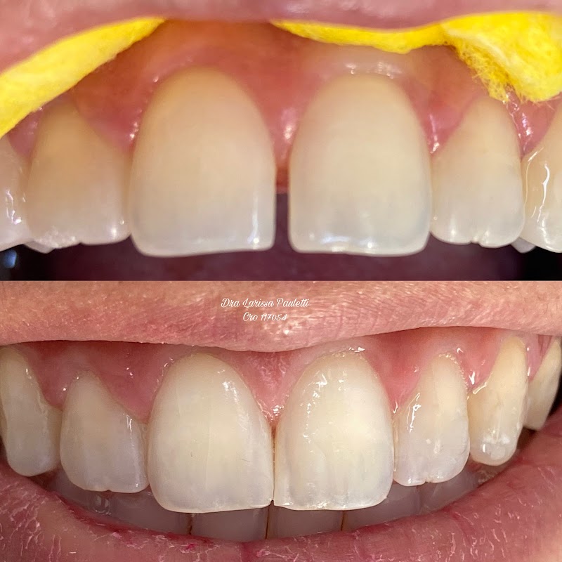 Dra Larissa Pauletti - Dentista Sorocaba - foto 2