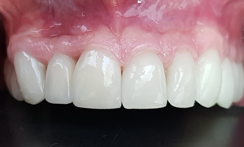 Novadent | Dentista | Implante Dentário | Centro | São Gonçalo - RJ - foto 2