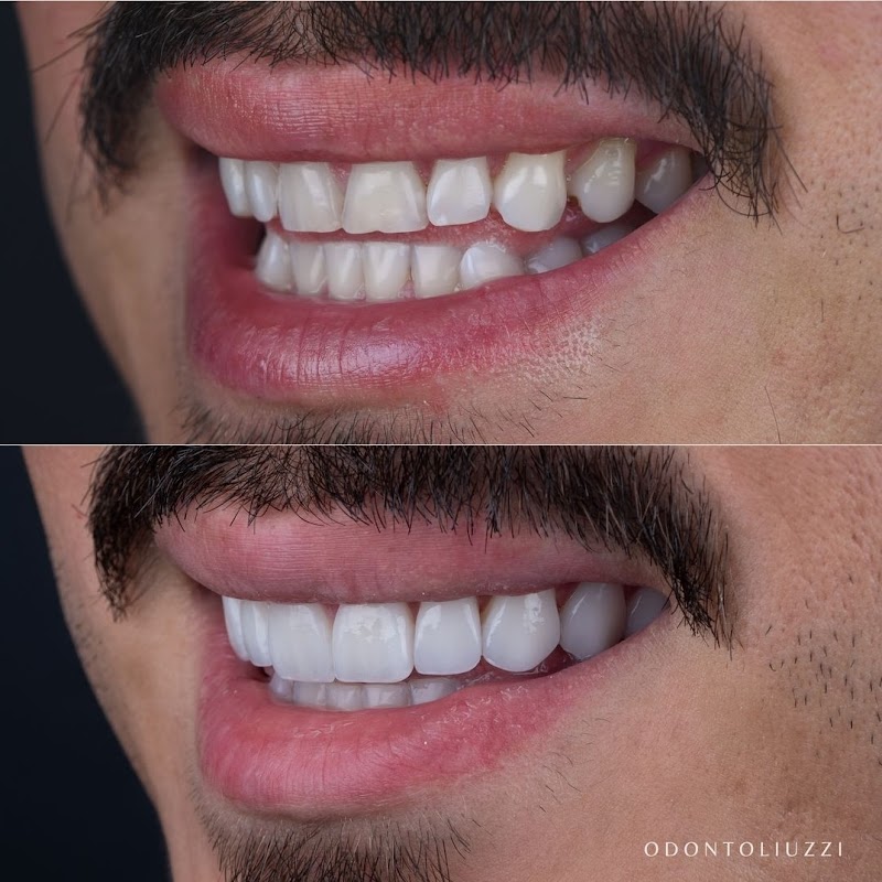 Odonto Liuzzi | Lentes de Contato Dental | Prótese Protocolo | Ortodontia | Periodontia | Implante Dentário | Dental Tourism - foto 2