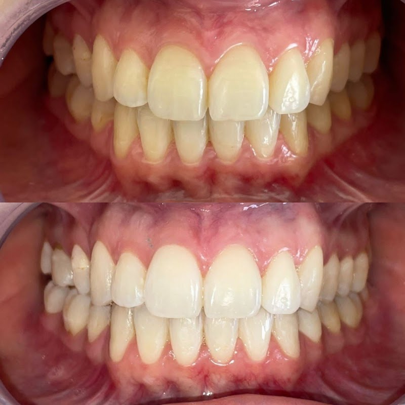 Dra Letícia Iandeyara - Dentista - Ortodontia e Alinhadores - foto 3