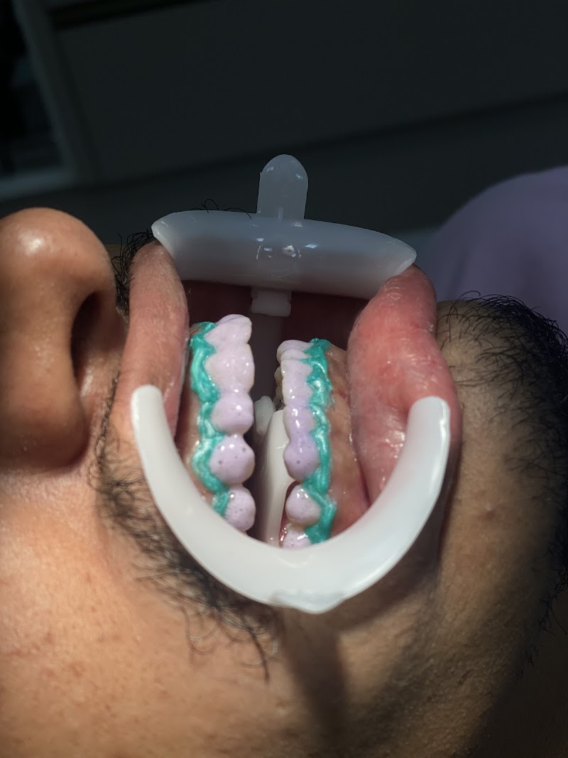 Dentista Harmonização Manaus Preenchimento Labial Dra. Anne Sadala - foto 5