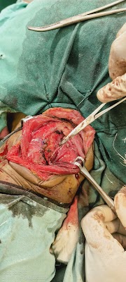 Dr BAIDYANATH OJHA, (MS )ENT & HEAD AND NECK SURGERY