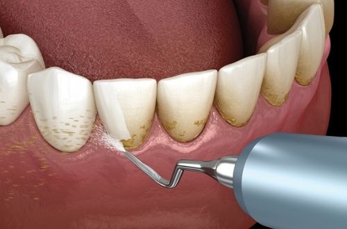 Al Abrah Clinic - Dental | Medical | Dermatology | Home healthcare 2