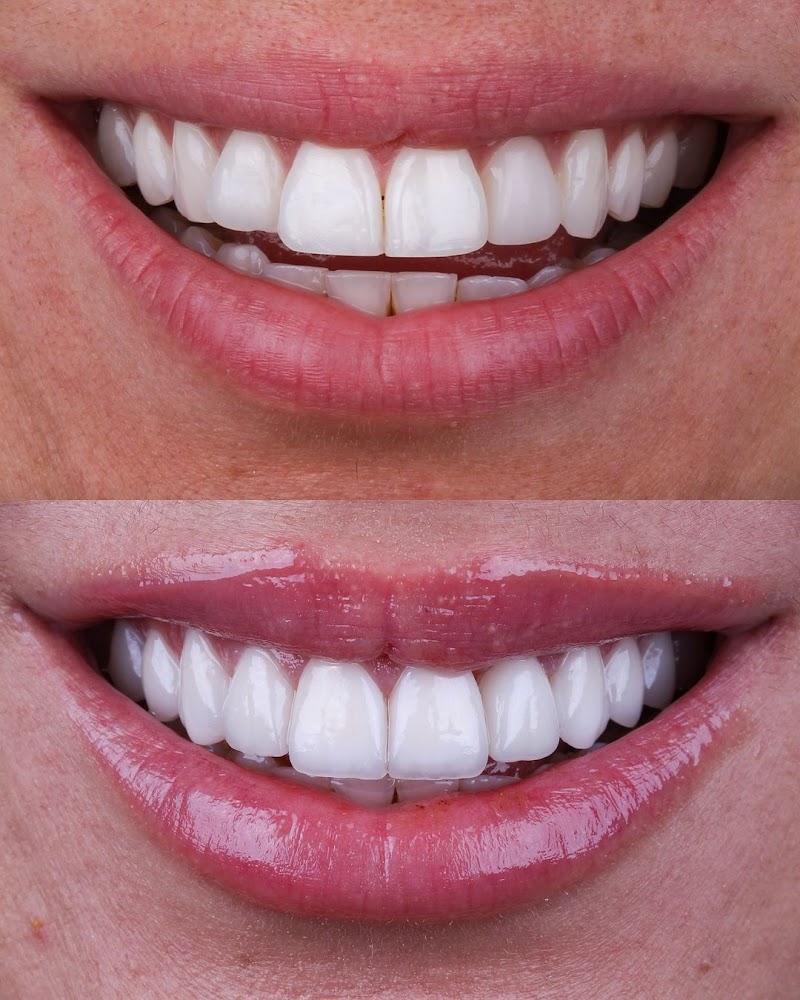 Oralfy Teresina - Implantes • Facetas • Invisalign • Próteses - foto 3