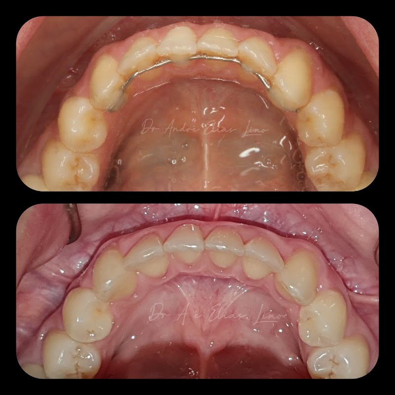 Dr. André Lino | Implante Dentário - foto 3