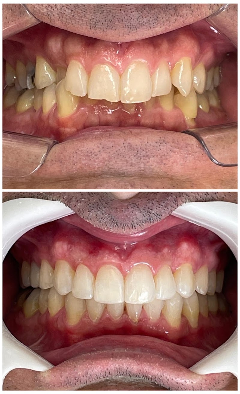 Dra Raquel Ribas- Invisalign Doctor Brasília - foto 3