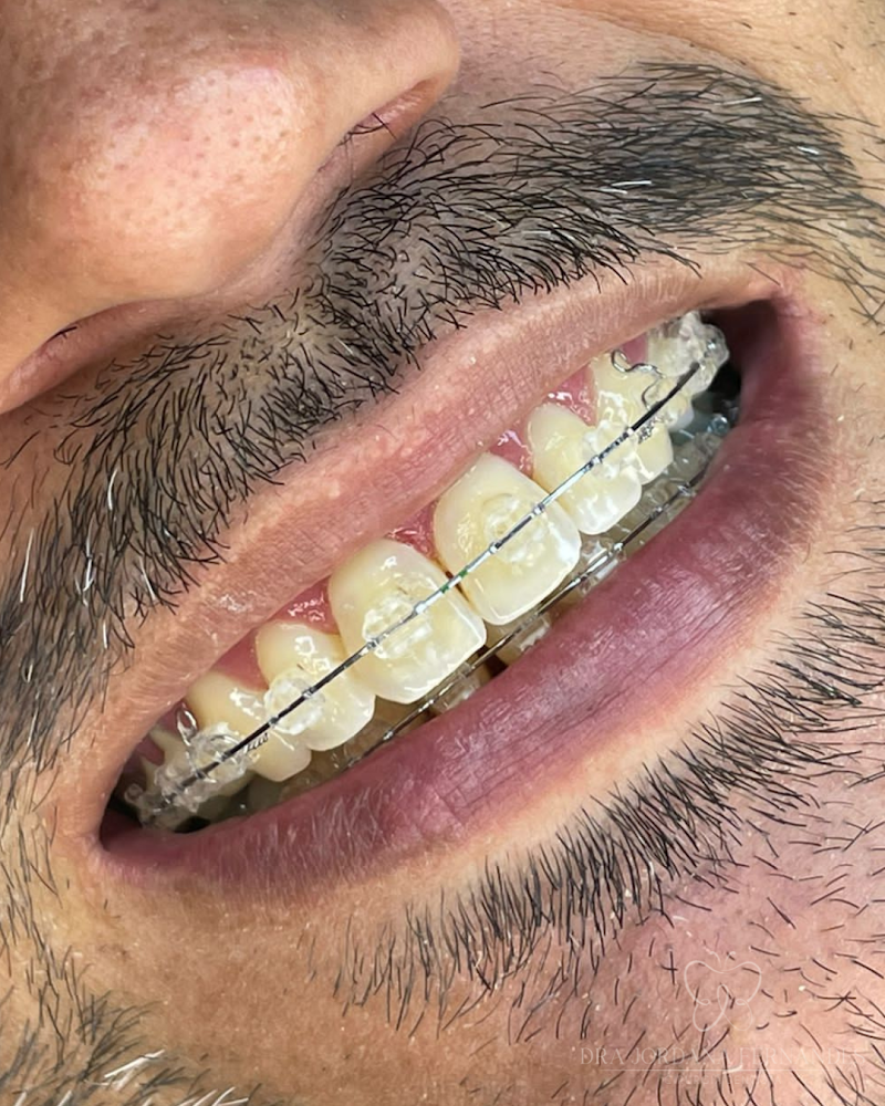 Dra Jordana Fernandes Periodontia