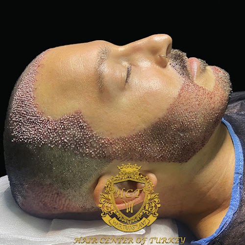 Best Hair Transplant Clinic in Turkey - Hair Center of Turkey Hair Transplant Clinic logo