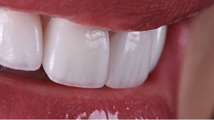 Dr. Ricardo Lippo | Dentista em Recife | Implantes dentários