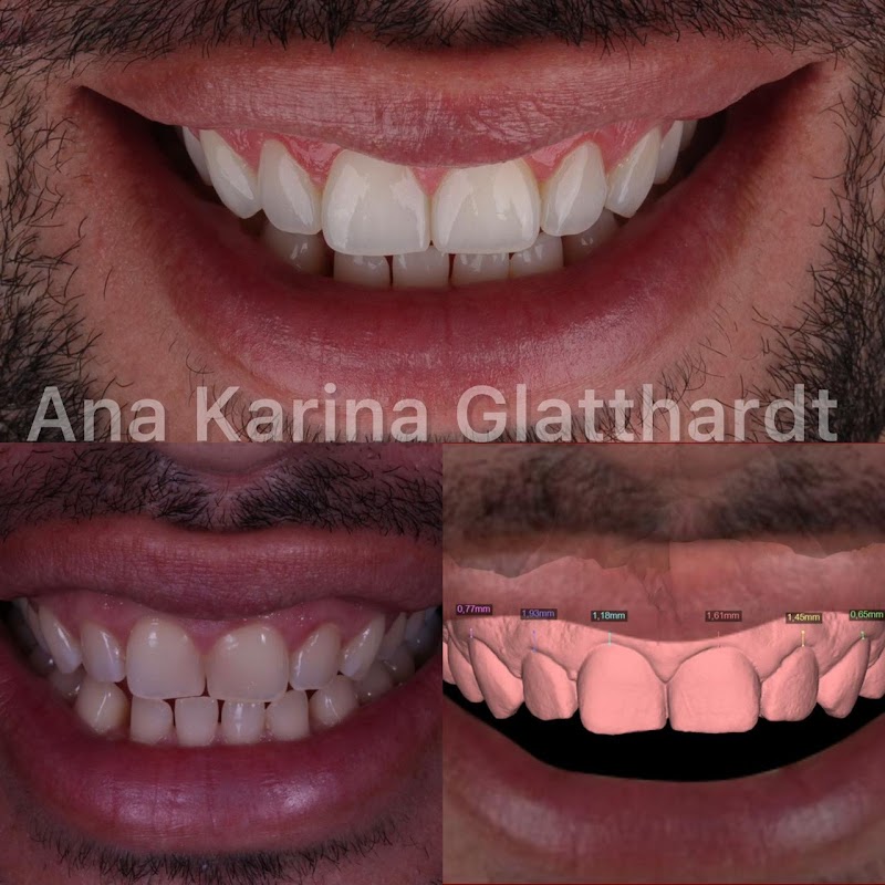 Dra. Ana Karina Glatthardt - Especializada em Implantodontia, Protesista e Cirurgias Gengivais na Tijuca - RJ