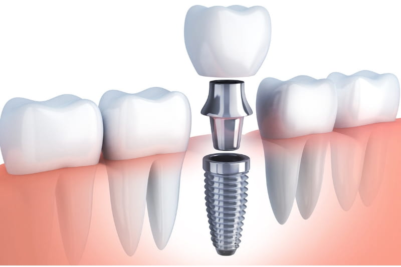 Dentalklinikken - billede 4