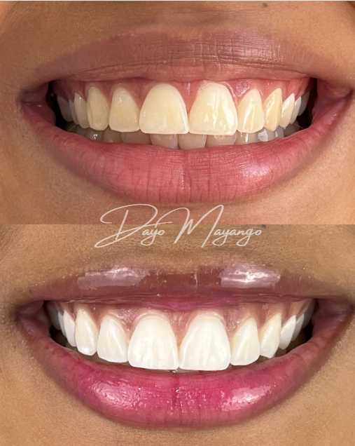 MD Odontologia Estética e Reabilitação Oral - foto 4