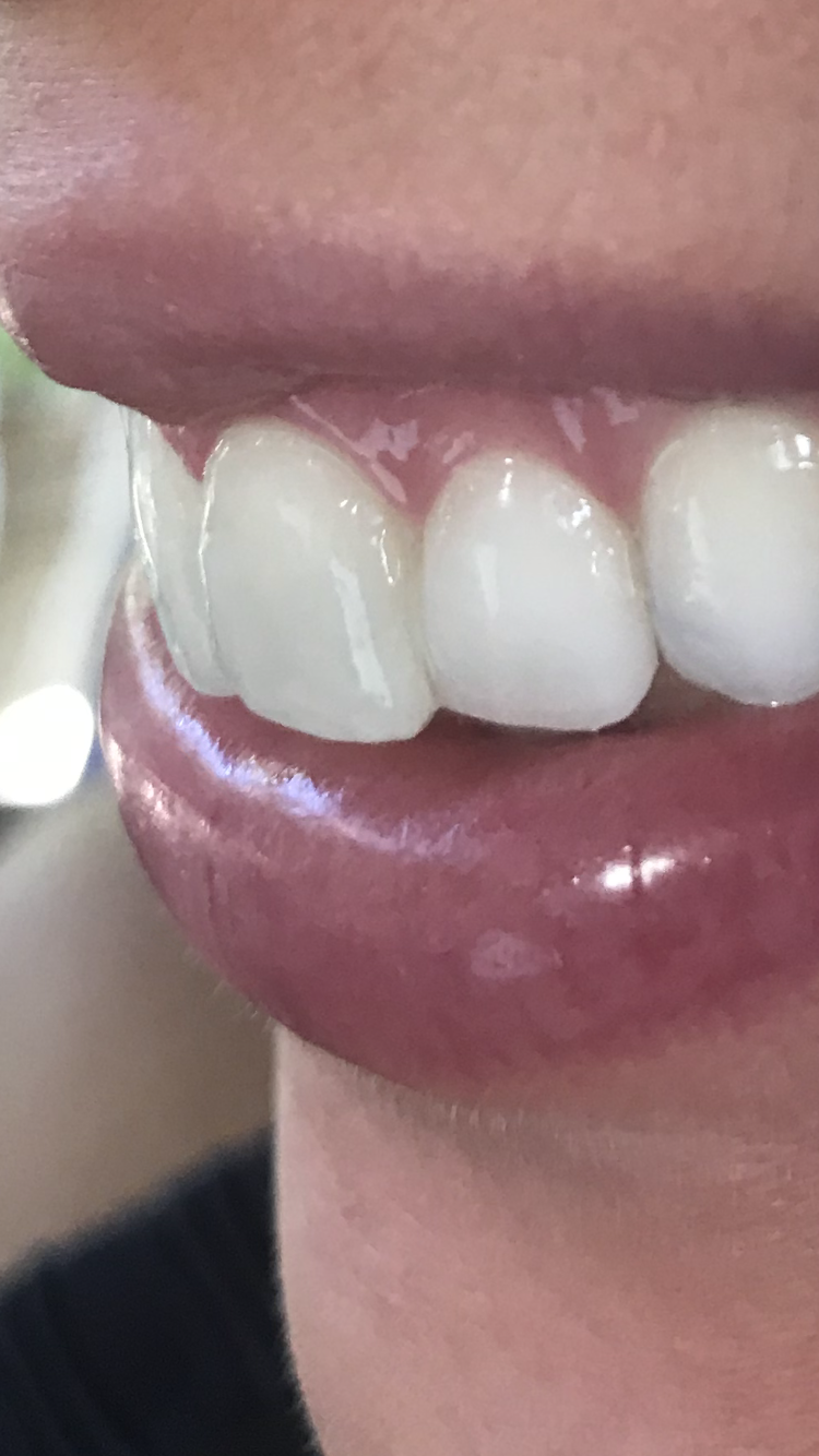 Dentista Dra. Eleanor Sardenberg- Clínica Odontológica Boca e Saúde - foto 4
