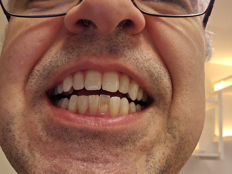 Dra. Regla Odontologia Estética | Restauração Dental - foto 5