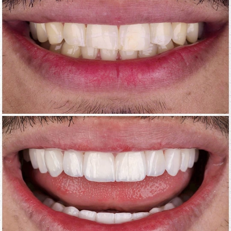 Dra. Regla Odontologia Estética | Restauração Dental - foto 2