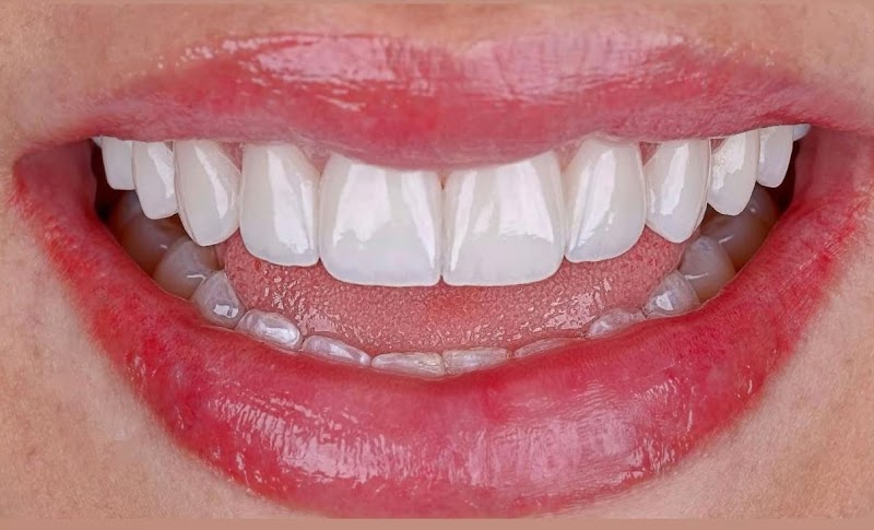 Dra. Regla Odontologia Estética | Restauração Dental