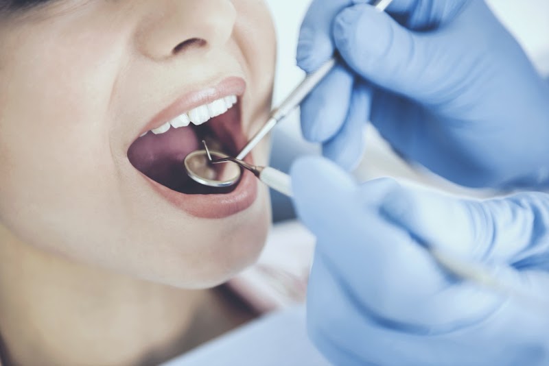 Impianti dentali a Roma I Clinicaltop