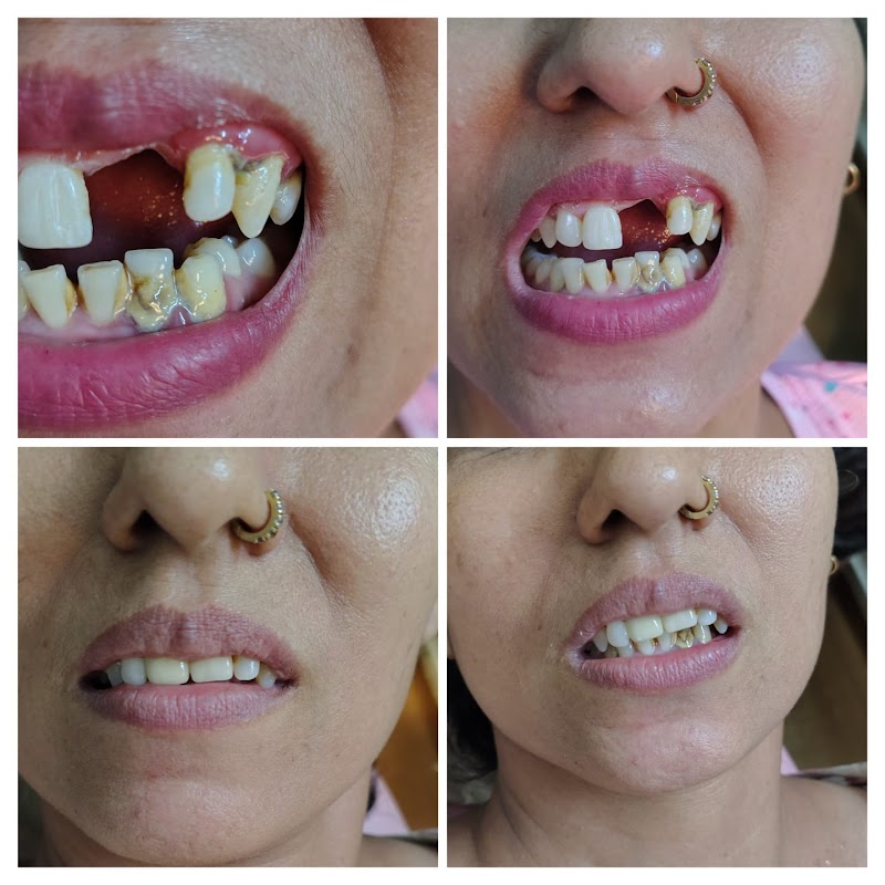 Kukkar Dental and smile care clinic